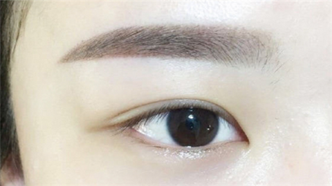 眼角修復(fù)手術(shù)多少錢(qián)？術(shù)后多久能恢復(fù)？