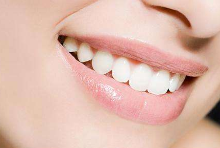 自鎖托槽矯正需要多久？