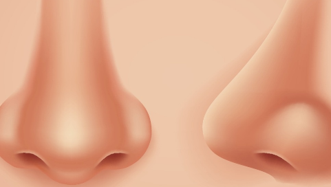 隆鼻假體材料哪種好？一般隆鼻哪種效果好？