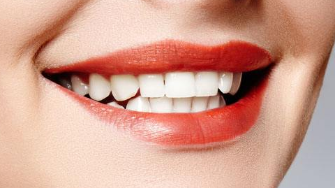 隱形托槽矯正的費(fèi)用是多少？