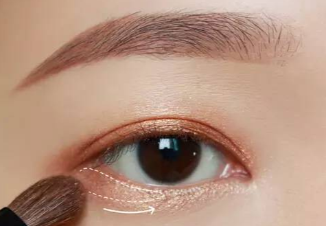 全切雙眼皮術(shù)后多久拆線？