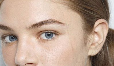 全切雙眼皮多久能恢復(fù)？