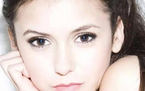 全切雙眼皮會(huì)留疤嗎？