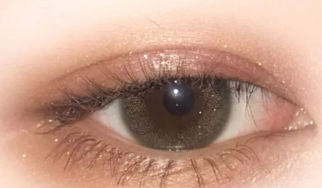 全切雙眼皮疼嗎？