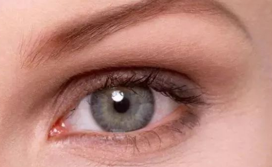 埋線雙眼皮能保持幾年？埋線雙眼皮會留疤嗎？