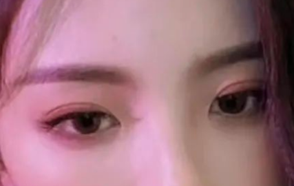 定點(diǎn)雙眼皮可以管多久？