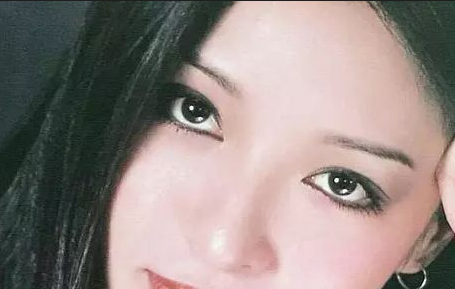 割雙眼皮會(huì)反彈嗎？