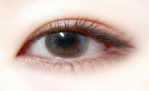 雙眼皮術后會反彈嗎？