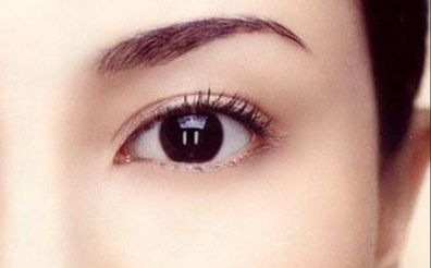 韓式開眼角多久能好？韓式開眼角多久能消腫？