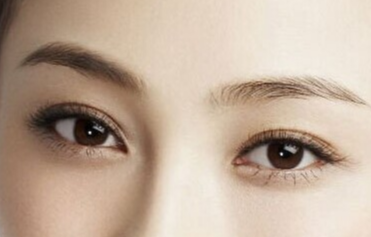 韓式開眼角手術(shù)的恢復(fù)時(shí)間？