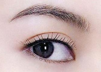 開(kāi)內(nèi)眼角的恢復(fù)期是多久？開(kāi)內(nèi)眼角的弊端有哪些？