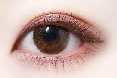 開(kāi)眼角術(shù)后多久才能恢復(fù)？