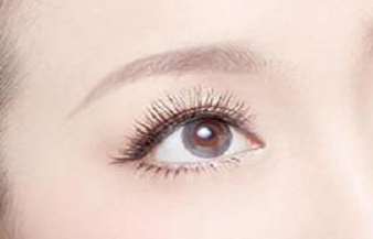 開眼角術(shù)后的護(hù)理要注意什么？