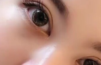 開眼角手術(shù)有什么別的方法？