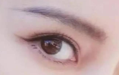 外眼角開大會(huì)留疤嗎？