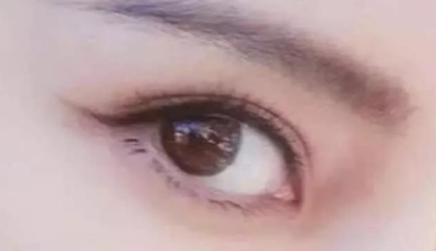 開眼角需要多久才能恢復(fù)？