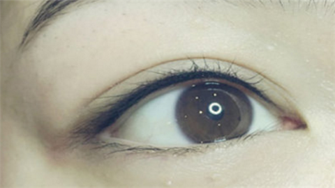 開眼角哪個(gè)醫(yī)院做的好？2022開眼角醫(yī)院排名前十