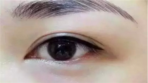 成都雙眼皮整形醫(yī)院哪家好？十家人氣醫(yī)院為你推薦！