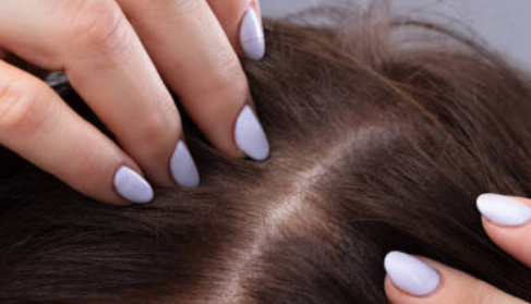 北京植發(fā)整形醫(yī)院哪幾家實(shí)力好？前十醫(yī)院最新名單公布！