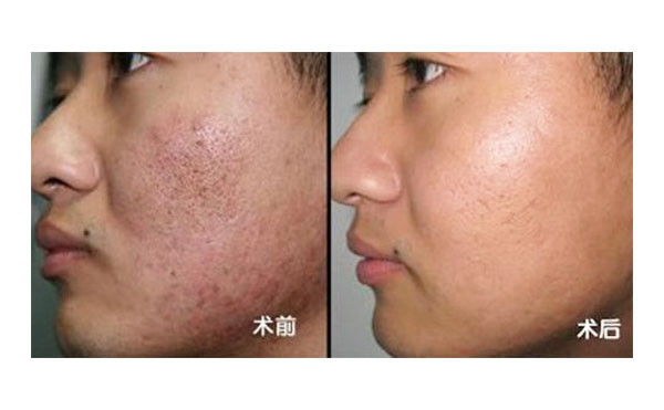 黑臉娃娃有風(fēng)險嗎？