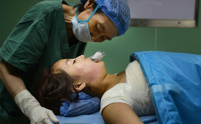 假體隆胸效果自然嗎？能維持多久？