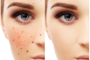 黑臉娃娃和白瓷娃娃