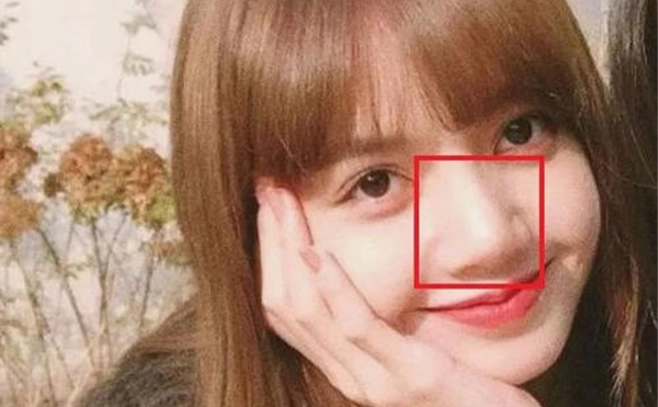 鼻子太大怎么辦？怎么改善大鼻頭