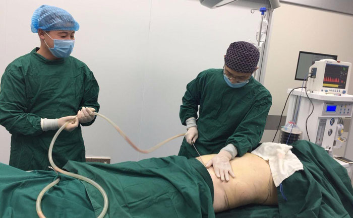 吸脂提臀線是怎么樣的？吸脂提臀多少錢？