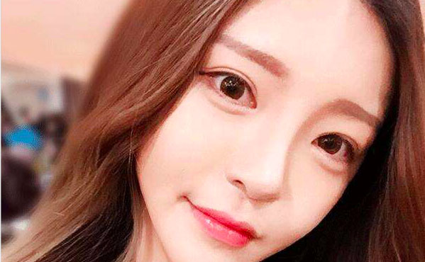 韓式開(kāi)眼角的費(fèi)用是多少？