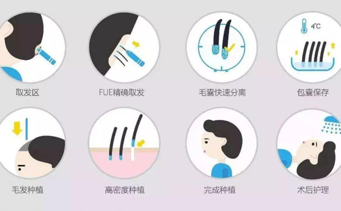 體毛種植的方法有哪些？