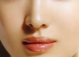 鼻子和下巴可以同時手術(shù)嗎？