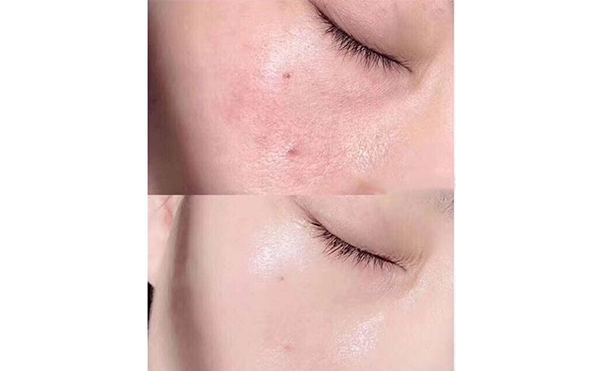 無針?biāo)忉槹踩珕幔? data-mce-src=