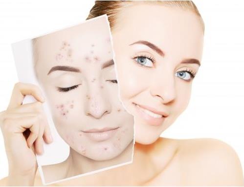 面部提拉緊致繃帶有效果嗎？