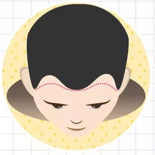 二級(jí)脫發(fā)