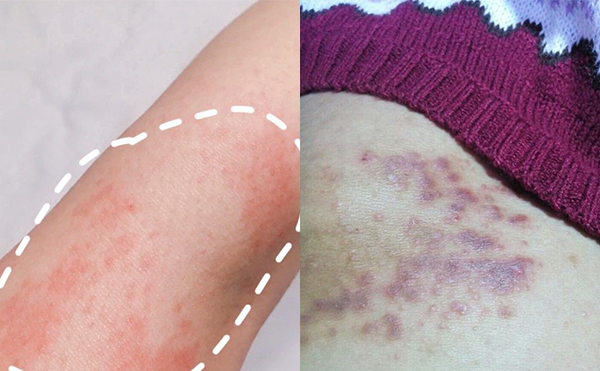 脫毛膏脫毛的效果怎么樣？