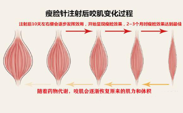 打瘦臉針打多少單位？
