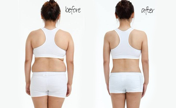 背部吸脂手術(shù)疼不疼？