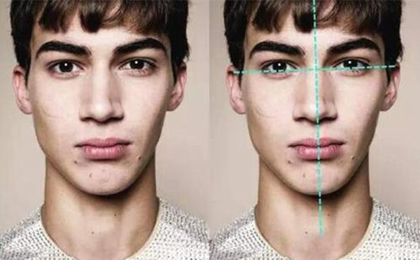 面部不對稱怎么矯正?具體有哪些方法?