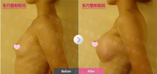 廣西南寧東方整形自然效果