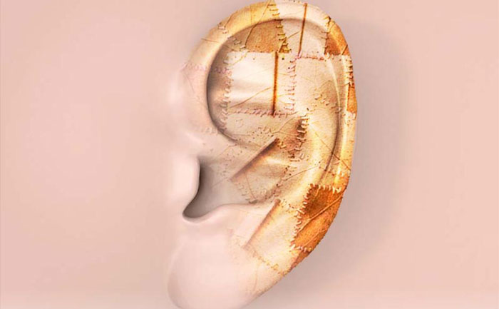 耳再造手術對軟骨有影響嗎？