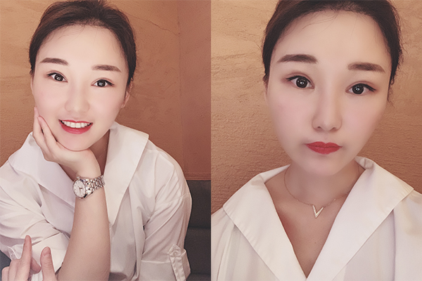 廣州韓非的李光琴院長(zhǎng)面部精細(xì)化整形