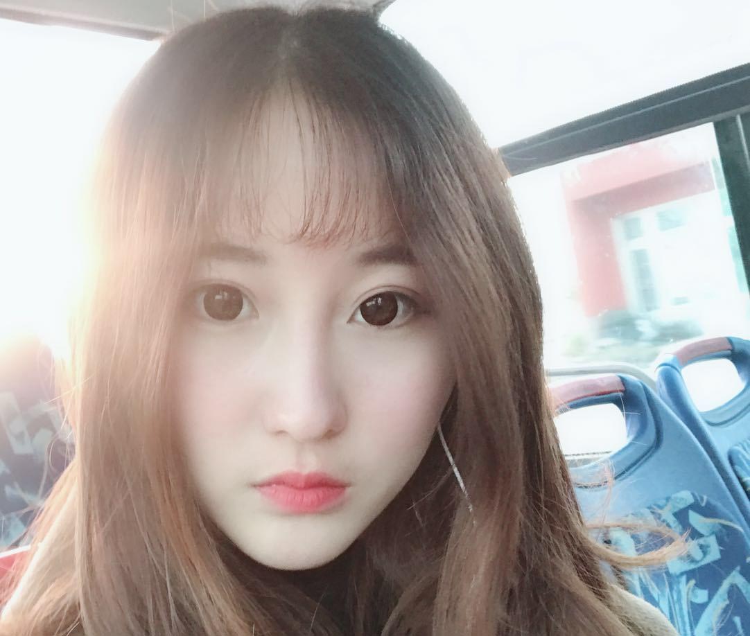 雙眼皮修復(fù)效果對比圖5