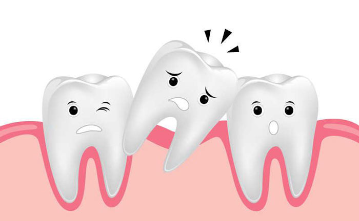 牙齒松動(dòng)還能恢復(fù)嗎？