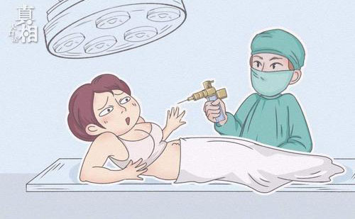 全身脂肪大概要多少錢？