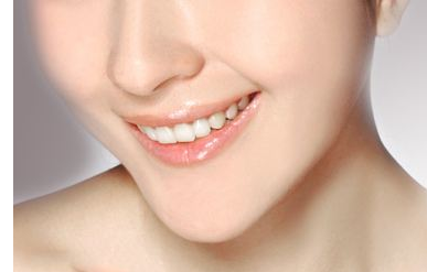 面部吸脂術(shù)適合哪些人群？