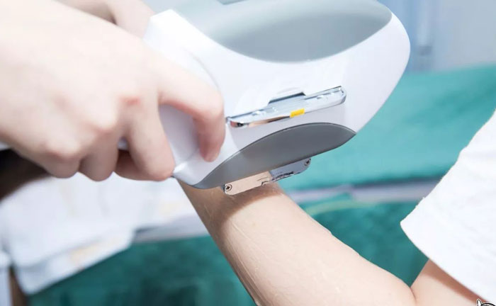 手臂脫毛多少錢？手臂脫毛幾次干凈？