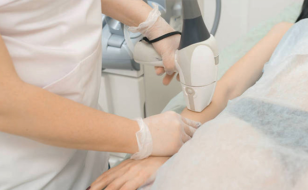 冰點脫毛的步驟是什么?有哪些需要注意的?