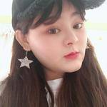 鼻基底整形案例對(duì)比4