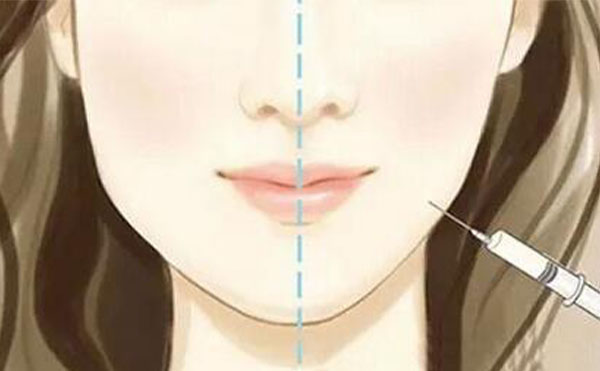瘦臉針可能會(huì)出現(xiàn)什么風(fēng)險(xiǎn)？