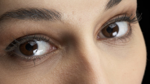 激光雙眼皮手術(shù)需要恢復多久？